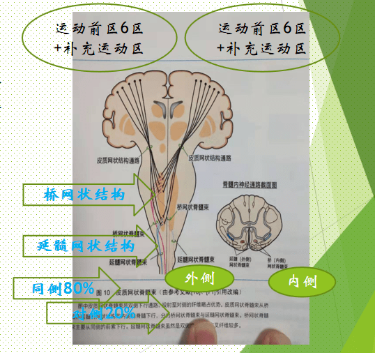 仿文化石瓷砖（仿文化石瓷砖怎么勾缝）,仿文化石瓷砖（仿文化石瓷砖怎么勾缝）,第1张