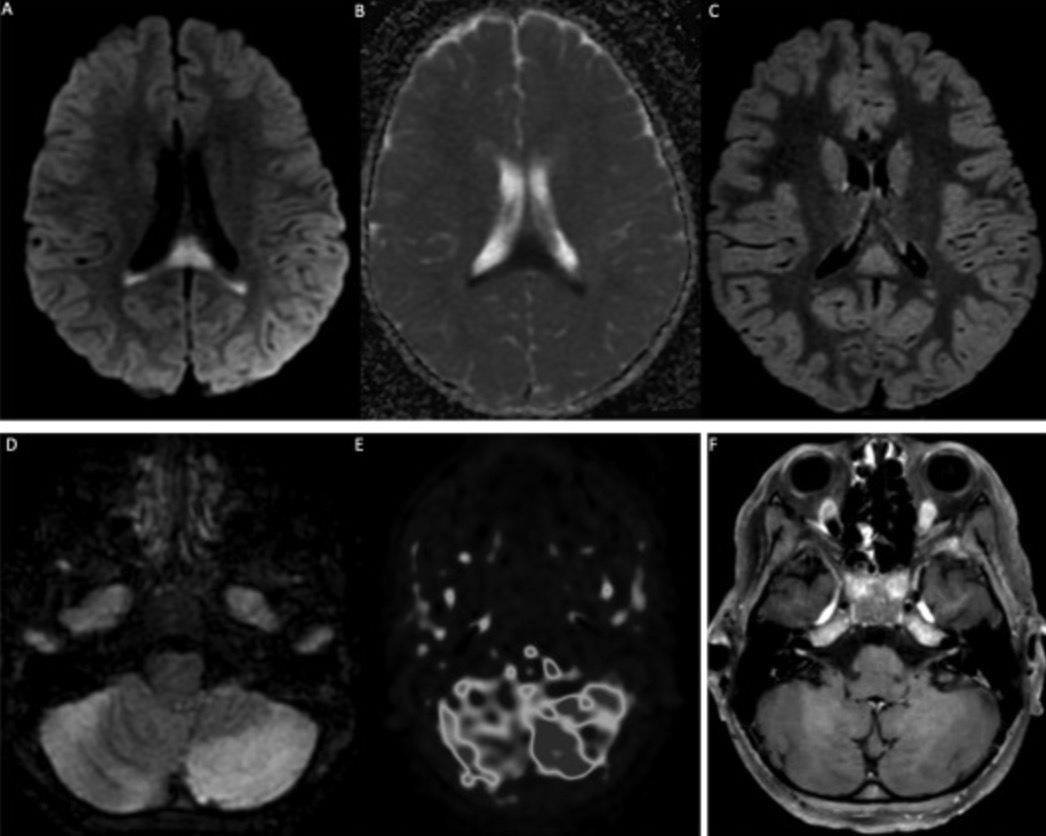 吸入空调氟利昂有毒吗?了解一下这种有害物质,第3张 吸入空调氟利昂有毒吗?了解一下这种有害物质,吸入空调氟利昂有毒吗?了解一下这种有害物质,第3张