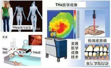 ABS塑料介绍及其应用领域分析,ABS塑料介绍及其应用领域分析,第2张